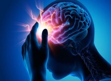 یک متخصص مغز و اعصاب: جوانان ایرانی ۷ برابر میانگین جهانی در معرض سکته مغزی‌اند
