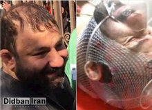 پلیس: کلیه‌های هانی کرده هم از کار افتاد