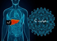 وزارت بهداشت: ایران به سمت حذف هپاتیت C حرکت می‌کند