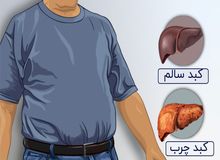 کبد چرب را با این روش به‌راحتی درمان کنید