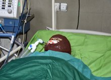 اسیدپاشی هولناک روی پدر و دختر در تهران/ انگیزه همسایه اسیدپاش چه بود؟