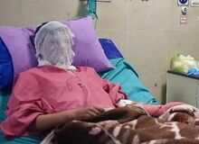 مردم ایران ۸ برابر متوسط جهانی دچار سوختگی می‌شوند/ مرگ سالانه ۳ هزار ایرانی در اثر سوختگی