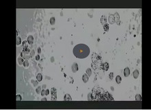 ویروس کرونا را زیرِ میکروسکوپ ببینید+ فیلم
