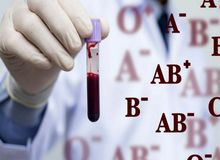 دارندگان گروه خونی A مستعدترین، افراد برای ابتلا به کرونا هستند