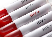 آخرین وضعیت HIV در کشور؛ تغییر الگوی راه انتقال و درصد ابتلای زنان و مردان / در شش ماهه اول امسال ۲۸ درصد موارد ثبت شده بیماری را زنان و ۷۲ درصد آن‌ها را مردان تشکیل می‌دهند