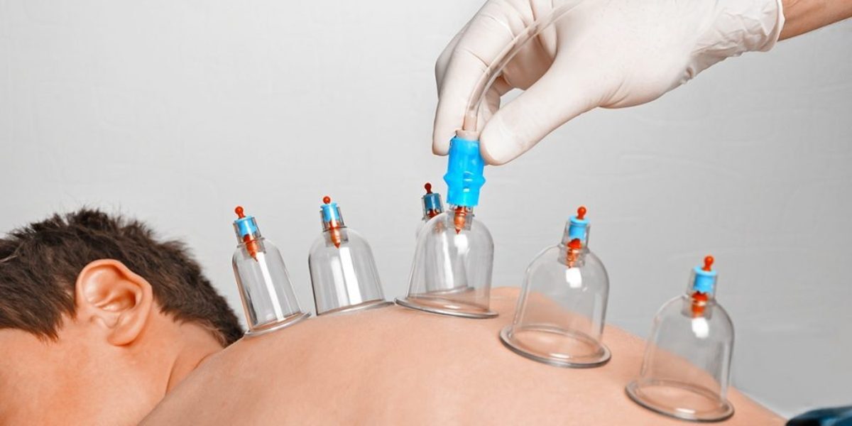 ۸ نکته درباره حجامت از درمان میگرن تا فشار خون
