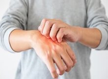 علائم هشدار دهنده هپاتیت C روی پوست