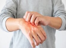 علائم هشدار دهنده هپاتیت C روی پوست