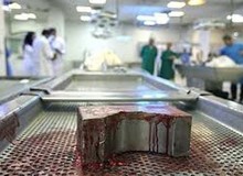 تایید، تکذیب، کتمان/ عضو کمیسیون بهداشت : در جلسه  فردای کمیسیون مسئله فروش «جسد توسط مافیا» را مطرح می کنیم / رئیس سازمان پزشکی قانونی: جسد فروشی نداریم 
