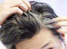 استرس و فشار عصبی باعث سفیدی مو می شود