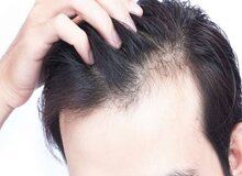 ۵ روش موثر برای جلوگیری از ریزش موی سر