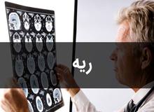 فوق تخصص بیماری‌های ریه: در فصل پاییز و زمستان، آنفلوآنزا هم به کرونا اضافه می‌شود/ PCR در بهترین شرایط می‌تواند تا ۶۰ درصد مثبت بودن کرونا را نشان بدهد