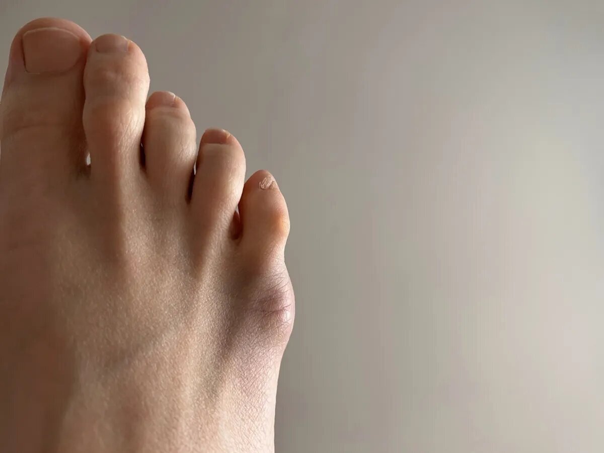 وظیفه بزرگِ انگشت کوچک پا / اگر نباشد چه می‌شود؟