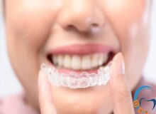مراحل ارتودنسی دو فک چگونه است؟