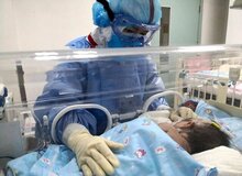 نوزاد ۲۳ روزه بر اثر کرونا درگذشت 