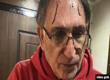 کیهان: قرمز بودن چند جای پیشانی نوری زاد، تلاش برای براندازی با گریم سس گوجه فرنگی بود