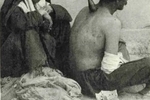 مرد قاجاری در حال حجامت شدن توسط یک زن / عکس