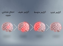 برای مقابله و پیشگیری از آلزایمر باید چه کارهایی را انجام دهیم و از چه مواد غذایی باید استفاده کنیم؟/ با ۹ ماده غذایی برای کاهش خطر ابتلا به بیماری آلزایمر آشنا شوید
