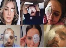 گزارشی از روند پرونده آسیب دیدگان چشم اعتراضات سال قبل در گفتگو با وکلای آنها: زخم اعتراض