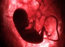 توقف تولید کیت غربالگری تکذیب شد