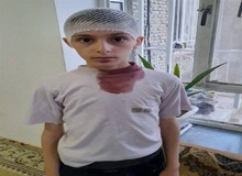 پرتاب تخته پاکن از سوی «معلم» سر دانش آموز را شکست 