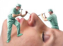 سن انجام عمل‌های زیبایی به زیر ۱۴ سال رسید