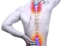 متخصص جراحی ستون فقرات در تهران