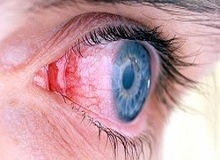 مصرف سیگار به بینایی چشم آسیب می زند + بیشتر بدانید