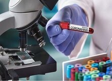 سپاه: با استفاده از کیت تزریقی در ۱۰ دقیقه کرونا را شناسایی می کنیم
