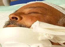 وزیر سابق بهداشت به دلیل سقوط در چاله آسانسور در بیمارستان بستری شد+ عکس